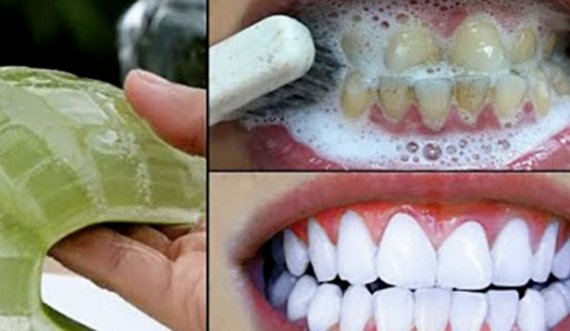 Po përdoret nga të gjithë, kjo është metoda e pastrimit të dhëmbëve me bimën e njohur Aloe Vera