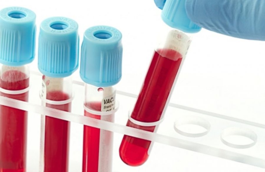 Testi i gjakut mund të diagnostikojë saktë këtë lloj kancer