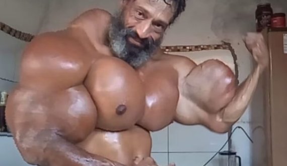 Injektonte substancën e rrezikshme për muskuj, vdes “Hulku brazilian”