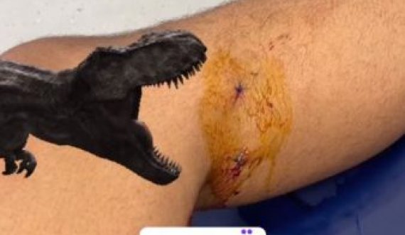 Basketbollisti amerikan sulmohet nga qentë endacakë në Pejë