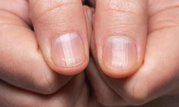 Gjatësia e gishtit tuaj mund të tregojë rrezikun për t’u prekur nga kanceri