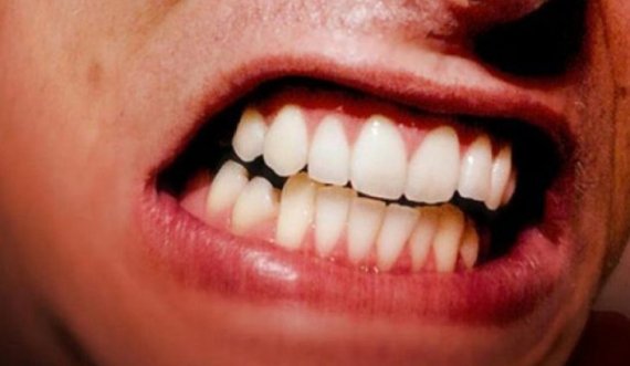 Nëse jeni një nga miliona njerëz që kërcasin ose shtrëngojnë dhëmbët gjatë gjumit, ja zgjidhja