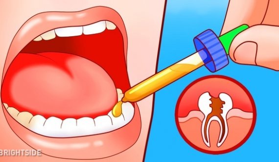 Largoni dhimbjet e dhëmbit në mënyrë natyrale
