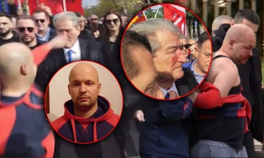 Flet para hetuesve agresori që grushtoi Berishën: Kisha inat personal