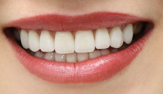 Dhëmbët e shëndoshë janë për disa nuanca më të errët