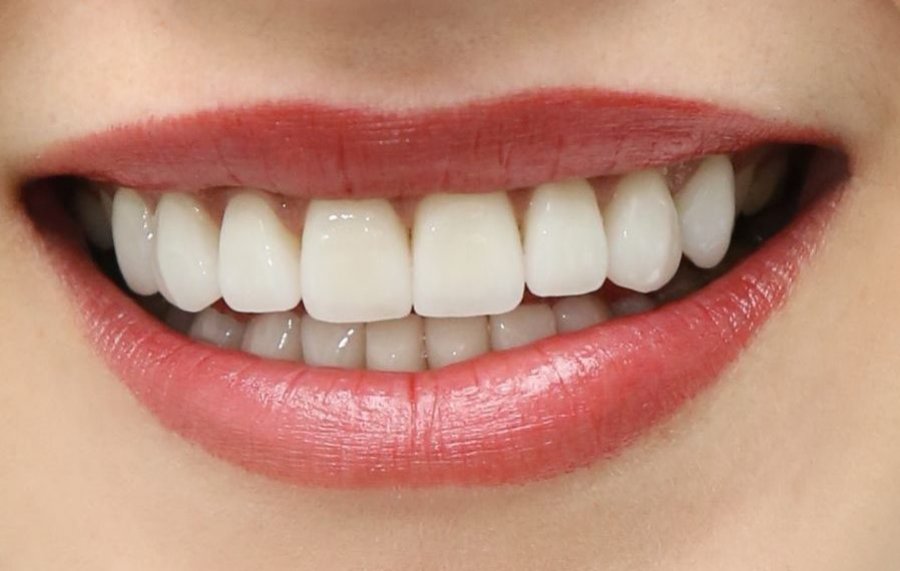  A e dini çfarë ndodh nëse letrën prej aluminit e mbani në dhëmbë për një orë?