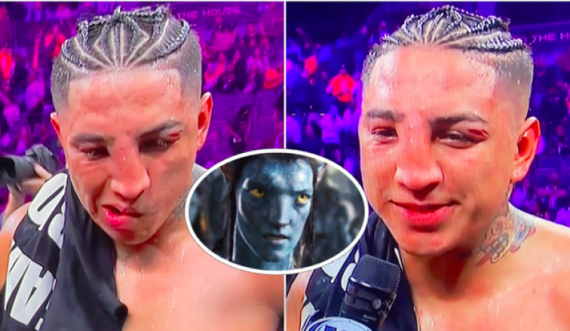 Mario Barrios mbeti me pamjen si të Avatarit, pas lëndimeve brutale që pësoi ndaj Keith Thurman