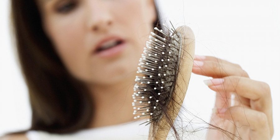 A e dini se gratë dhe burrat preken njësoj nga rënia e flokëve e trashëguar?