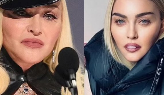 Fansat akuzojnë Madonnën për photoshop: Kjo nuk je ti, dukesh si 16-vjeç