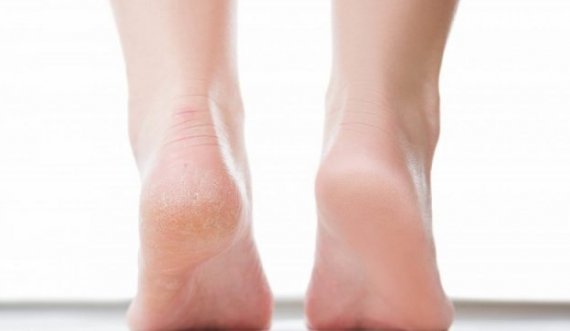 Thembrat e plasaritura? 2 receta natyrale për t’i hidratuar ato