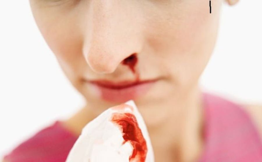 Gjak nga hundët? Çfarë sëmundjesh paralajmëron