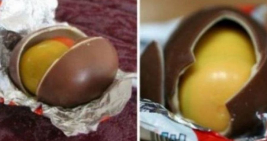 Fëmija tmerrohet nga dhurata që gjen brenda çokollatës