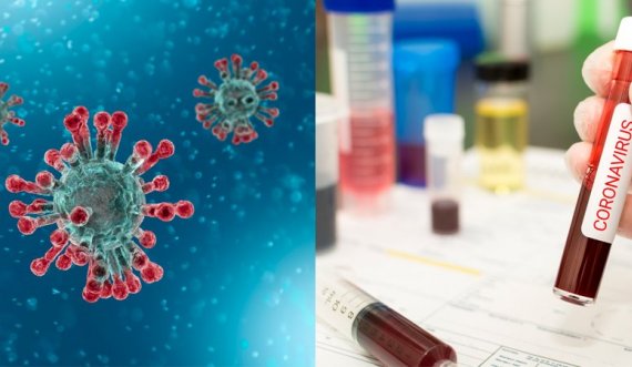 Mbi 5 mijë raste aktive me koronavirus, paralajmërohet përkeqësim i situatës epidemiologjike