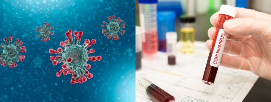 Mbi 5 mijë raste aktive me koronavirus, paralajmërohet përkeqësim i situatës epidemiologjike