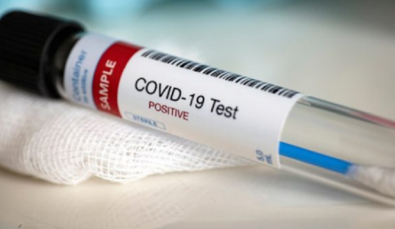 Shumica e të infektuarve me Covid-19, nga mosha 10 deri 19 vjeç
