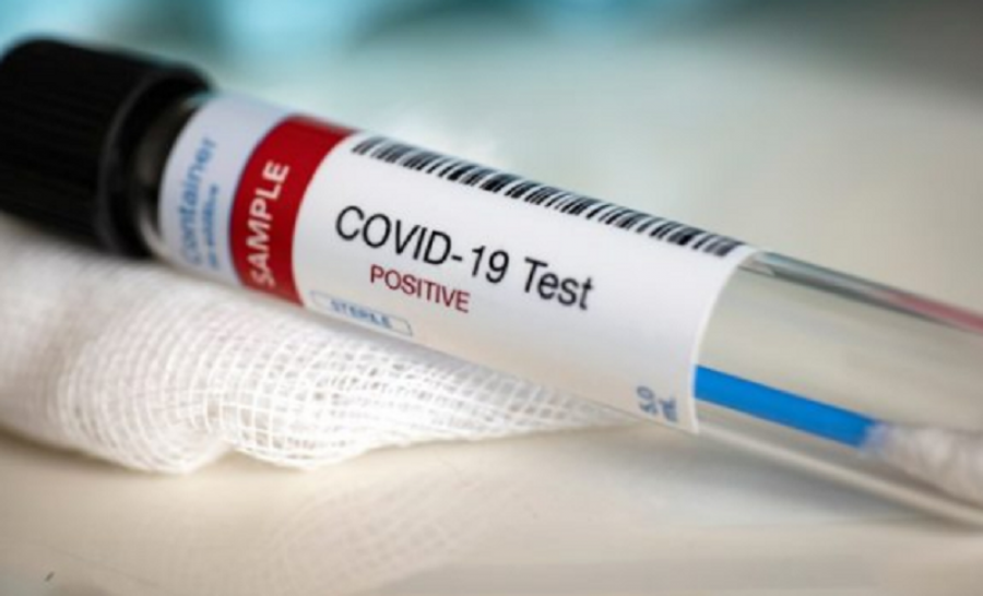 Shumica e të infektuarve me Covid-19, nga mosha 10 deri 19 vjeç