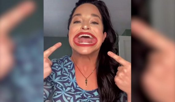 Gruaja me gojën më të madhe në botë: Ajo mund të vendosë tri krofne në të njëjtën kohë