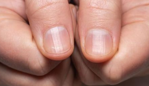 Kujdes! Gjatësia e gishtit mund të tregojë rrezikun për t’u prekur nga kanceri