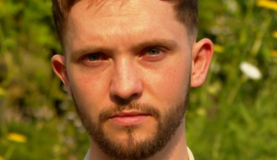 I riu që u infektua me linë e majmunit: Puçrrat u përhapën edhe në organet gjenitale