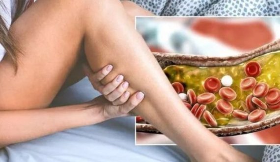 Përjetimi i dy llojeve të dhimbjes ‘në shtrat’ mund të sinjalizojë nivele të larta të kolesterolit