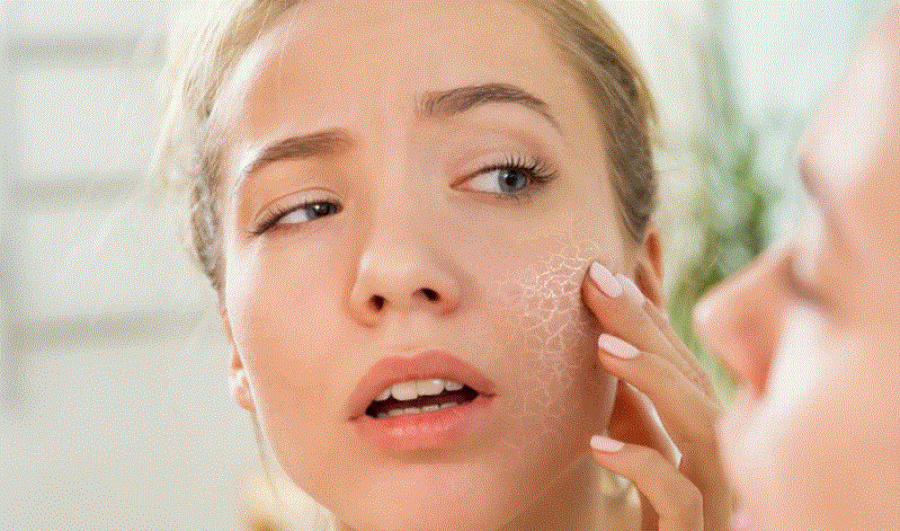 A keni lëkurë të thatë në verë? 