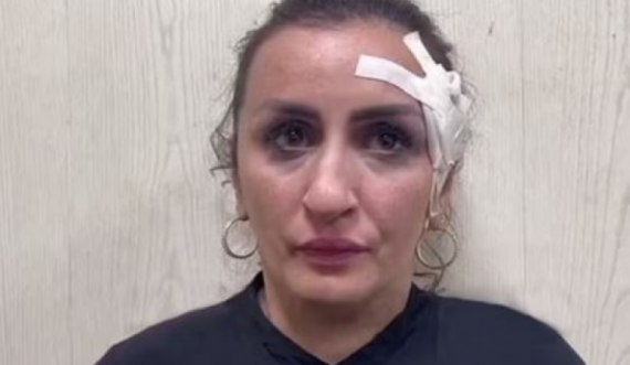 Nëna shet foshnjën e porsalindur për të bërë operacion plastik në hundë