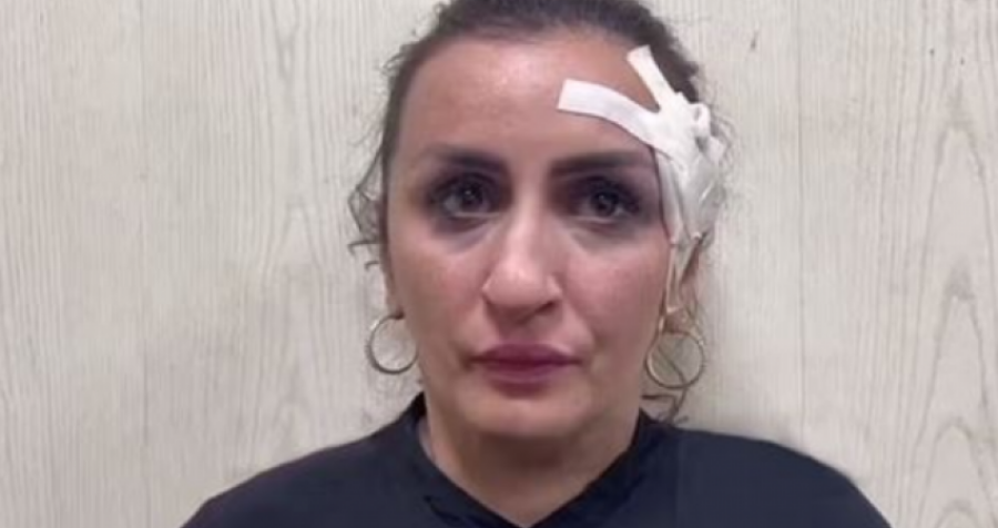 Nëna shet foshnjën e porsalindur për të bërë operacion plastik në hundë