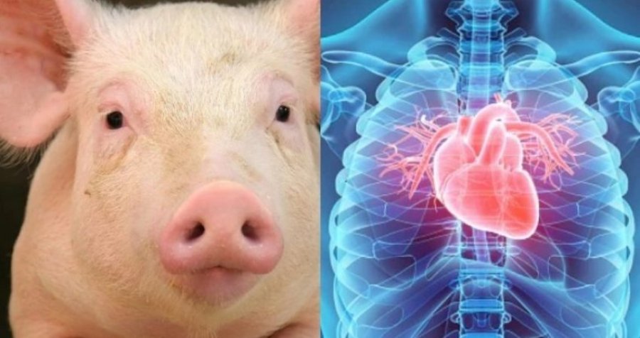 Kryhet transplantimi i dy zemrave të derrit edhe tek dy persona