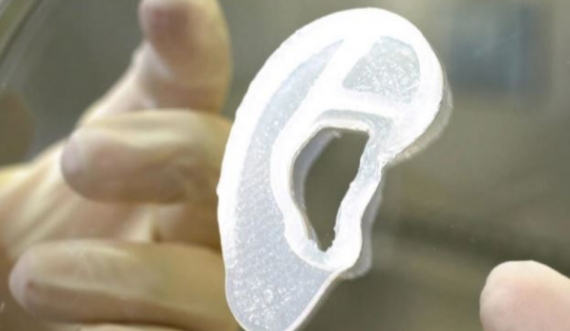 Transplantohet veshi 3D të bërë nga qeliza të gjalla