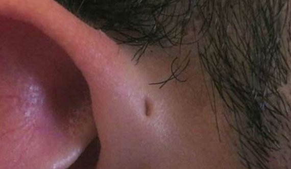 E keni këtë vrimë të vogël në vesh?