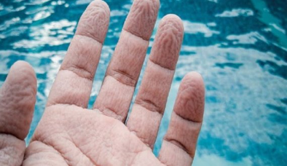 Pse rrudhet lëkura në gishta kur qëndron nën ujë?