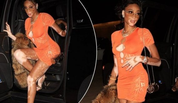 Winnie Harlow shfaqet e mahnitshme me një fustan të shkurtër portokalli