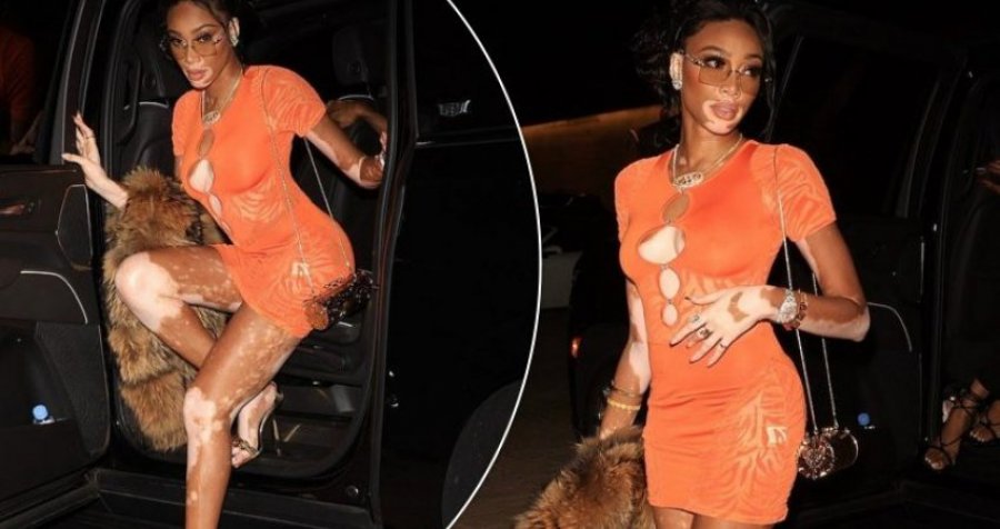 Winnie Harlow shfaqet e mahnitshme me një fustan të shkurtër portokalli