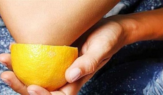 Për bërrylat e lënduar zgjidhja është një dhe gjendet në kuzhinë