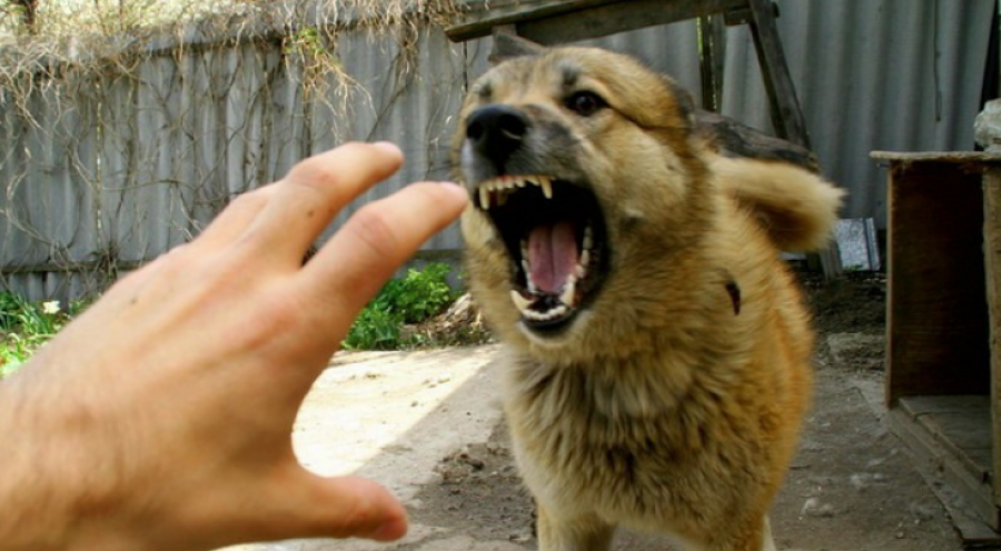 Sekondat janë vendimtare: Si të mbroni veten kur sulmoheni nga qeni?