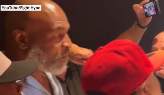 Tjetër incident për Tysonin, fansja ia prek hundën
