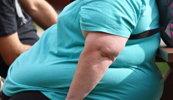 “Epidemia” e mbipeshës, OBSH tregon sa vdekje shkakton kjo sëmundje në vit