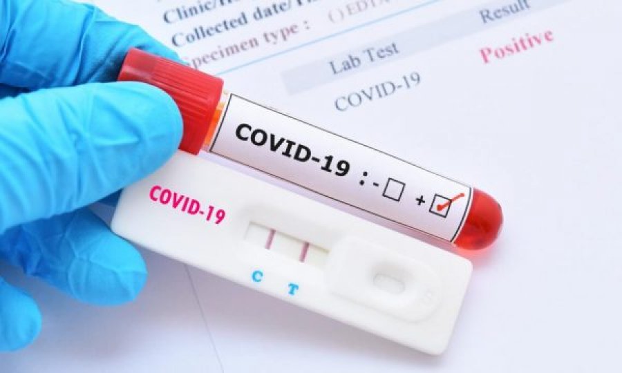 4 raste të reja me COVID-19, askush s’u vaksinua gjatë 24 orëve të fundit