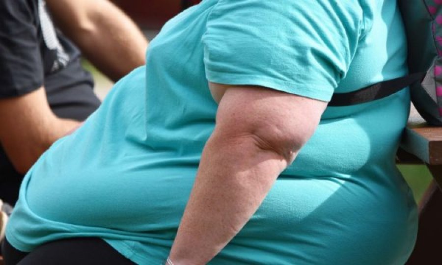 “Epidemia” e mbipeshës, OBSH tregon sa vdekje shkakton kjo sëmundje në vit