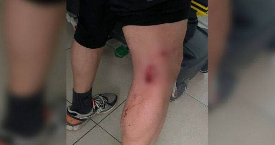 'Sulm në grup', qentë endacak e bëjnë për spital një burrë në Prishtinë