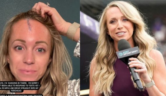 Gazetarja amerikane u godit nga një top bejsbolli me shpejtësi 153 km/orë