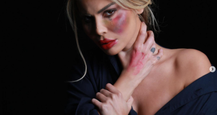 Luana Vjollca rrëfen momentet e sulmit të pesë 'fansave' të saj, një tentoi ta dhunojë