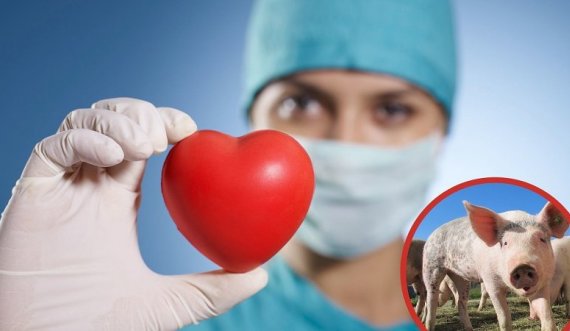 Transplanti i parë i zemrës nga derri te njeriu 