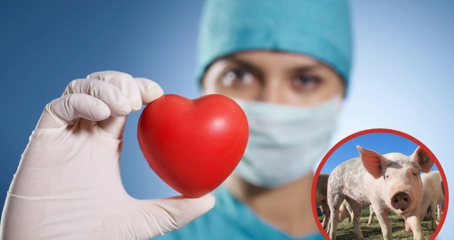 Transplanti i parë i zemrës nga derri te njeriu 