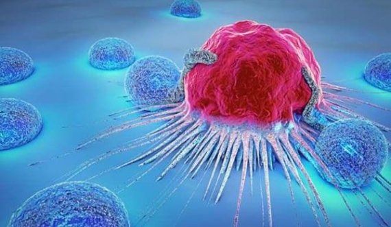 Shkencëtarët kanë zhvilluar një çip që zbulon qelizat e kancerit