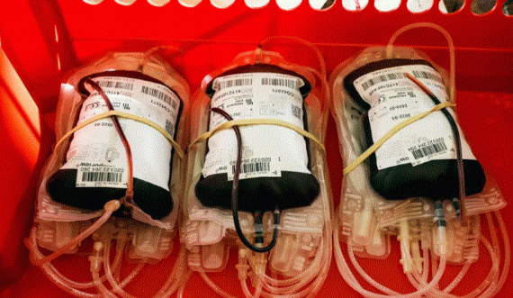 Studiuesit po provojnë transfuzionet e gjakut të prodhuar në laborator