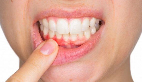 Mënyrat se si të shpëtojmë nga dhimbja e dhëmbit