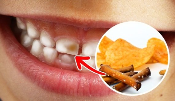 Shëndeti i dhëmbëve varet nga ushqimi, jo nga pasta