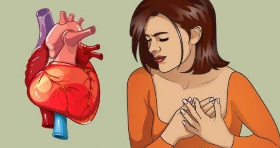 Këto simptoma të sulmeve në zemër shfaqen vetëm te femrat