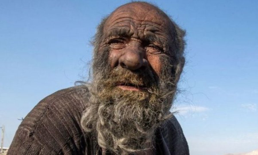 'Njeriu më i pisët në botë' lahet pas 60 vitesh, vdes disa javë më vonë